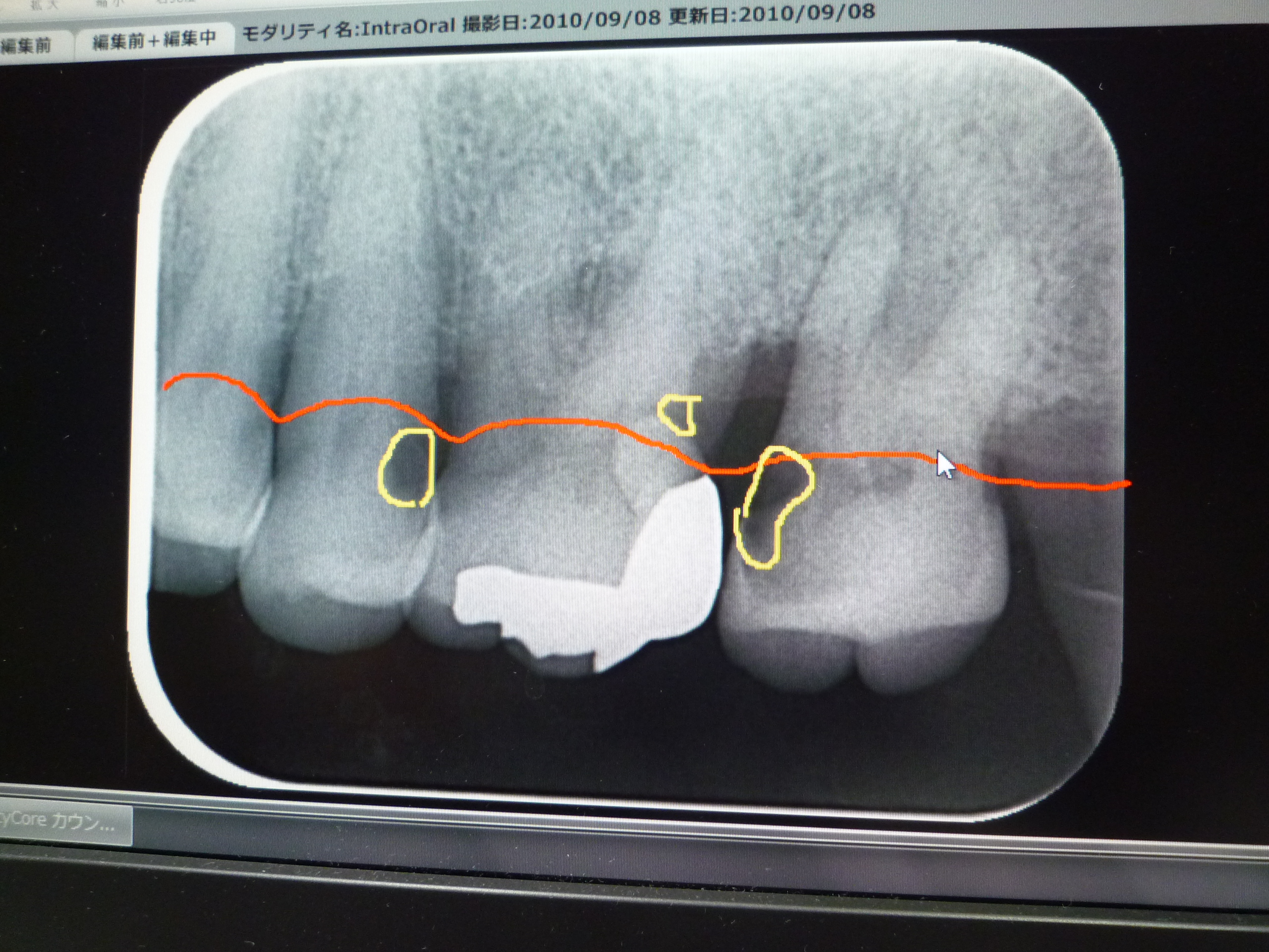 機器写真かのう加納歯科矯正網干姫路