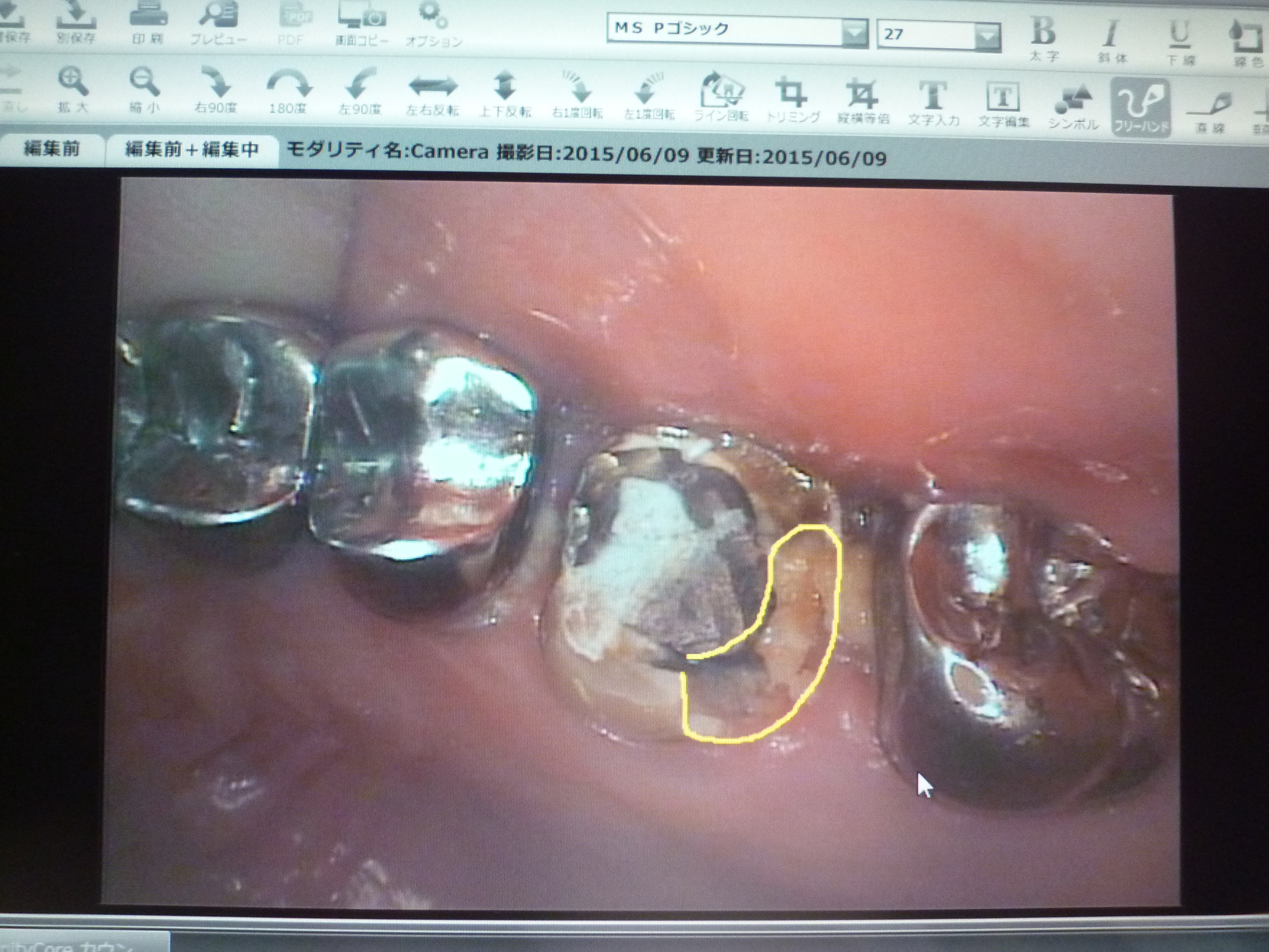機器写真かのう加納歯科矯正網干姫路